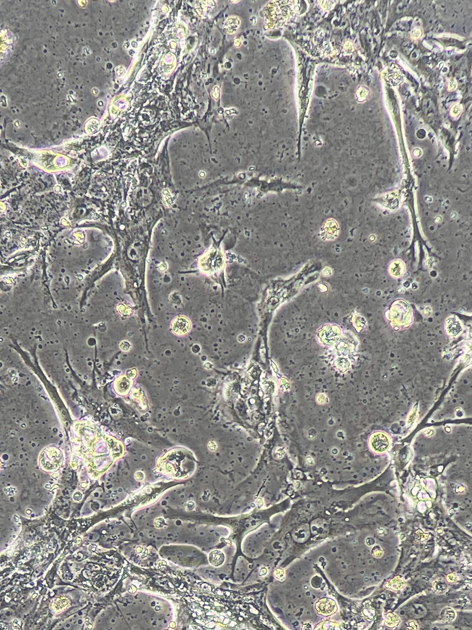 Extravillous trophoblast cells in culture